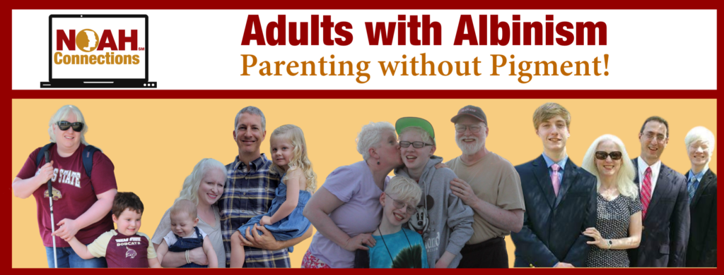NOAH Connections Adults with Albinism Parenting without Pigment