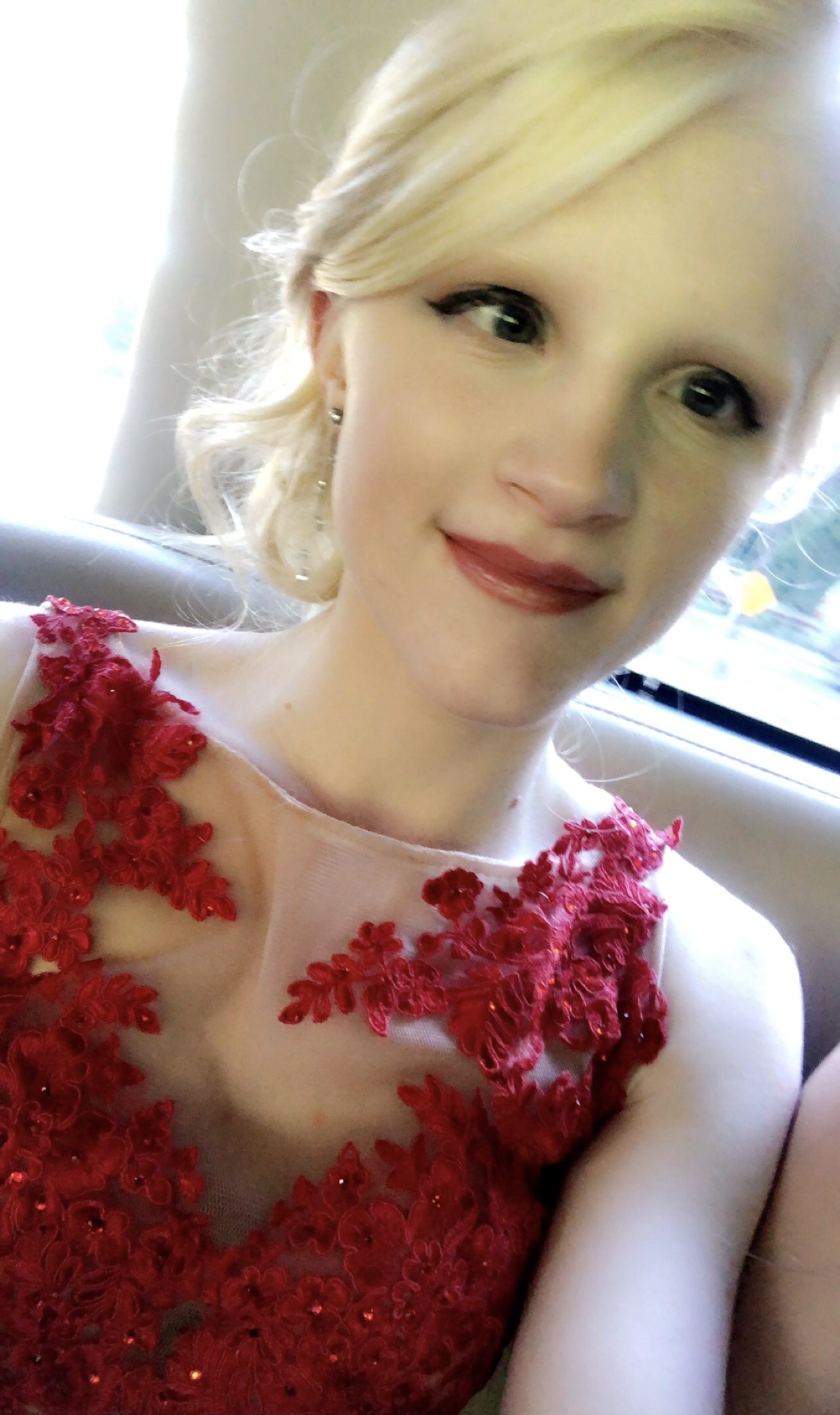 Elizabeth Schafer - National Organization for Albinism and Hypopigmentation