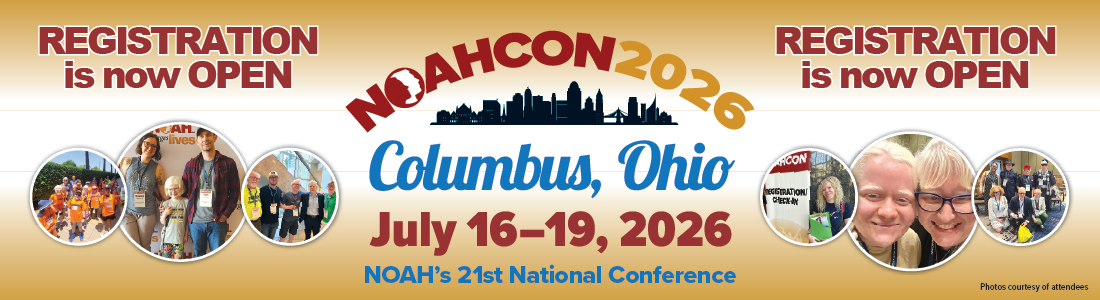 noahcon 26 reg open slider